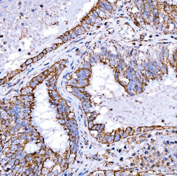 RAB7/RAB7A Rabbit Polyclonal Antibody