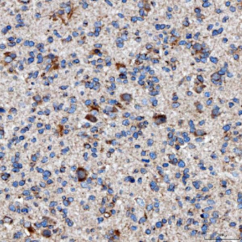 RAB7/RAB7A Rabbit Polyclonal Antibody