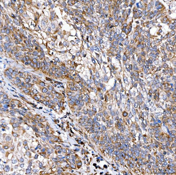 RAB7/RAB7A Rabbit Polyclonal Antibody