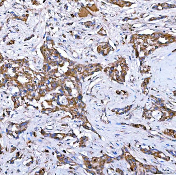 RAB7/RAB7A Rabbit Polyclonal Antibody