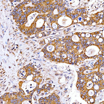 Rab4/RAB4A Rabbit Polyclonal Antibody