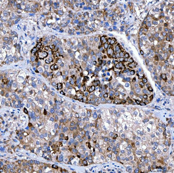 Rab4/RAB4A Rabbit Polyclonal Antibody