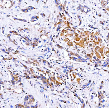Rab4/RAB4A Rabbit Polyclonal Antibody