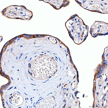 Rab4/RAB4A Rabbit Polyclonal Antibody