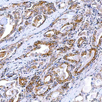 Rab4/RAB4A Rabbit Polyclonal Antibody