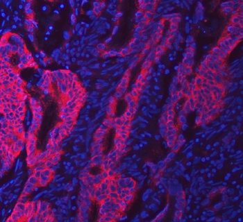 SWAP70 Rabbit Polyclonal Antibody