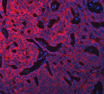 SWAP70 Rabbit Polyclonal Antibody
