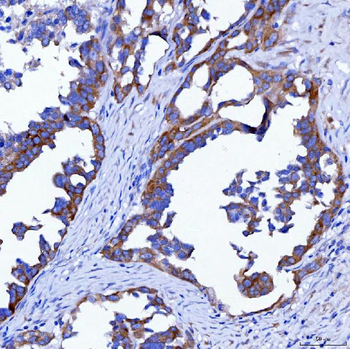 SWAP70 Rabbit Polyclonal Antibody