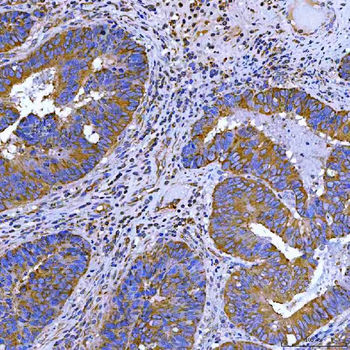 SWAP70 Rabbit Polyclonal Antibody
