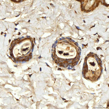 SPTBN2 Rabbit Polyclonal Antibody
