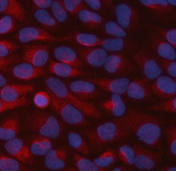 STBD1 Rabbit Polyclonal Antibody
