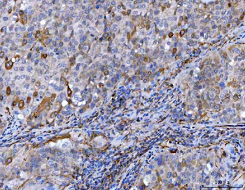 STBD1 Rabbit Polyclonal Antibody