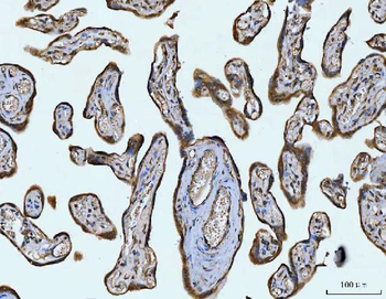 STBD1 Rabbit Polyclonal Antibody
