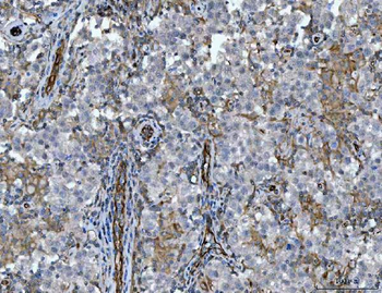 STBD1 Rabbit Polyclonal Antibody