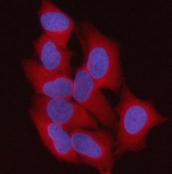 ST13 Rabbit Polyclonal Antibody
