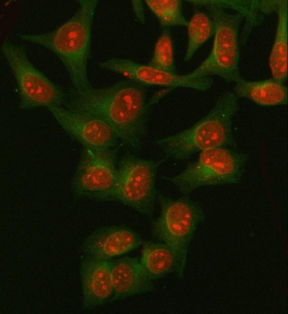 DNA Ligase IV/LIG4 Rabbit Polyclonal Antibody