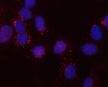 SNX6 Rabbit Polyclonal Antibody