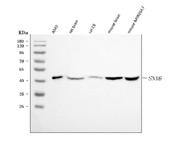 SNX6 Rabbit Polyclonal Antibody