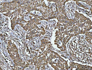 Porin/VDAC1 Rabbit Polyclonal Antibody