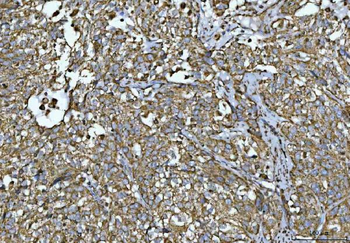 Porin/VDAC1 Rabbit Polyclonal Antibody