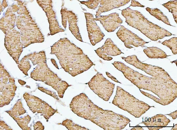 Porin/VDAC1 Rabbit Polyclonal Antibody