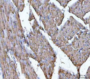 Porin/VDAC1 Rabbit Polyclonal Antibody