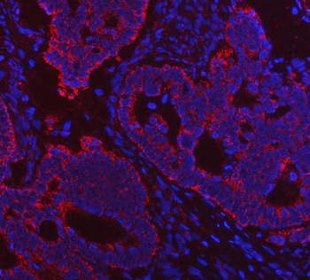 Porin/VDAC1 Rabbit Polyclonal Antibody