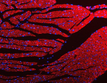 Porin/VDAC1 Rabbit Polyclonal Antibody