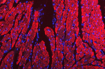 Porin/VDAC1 Rabbit Polyclonal Antibody