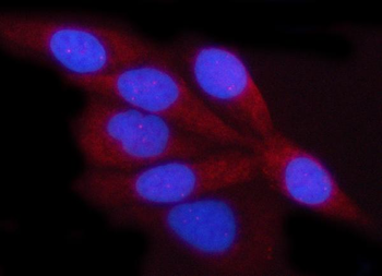 Porin/VDAC1 Rabbit Polyclonal Antibody