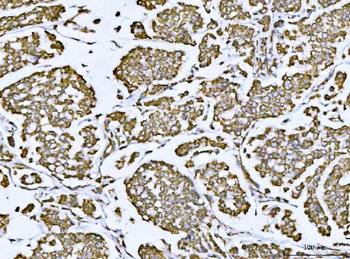 Porin/VDAC1 Rabbit Polyclonal Antibody