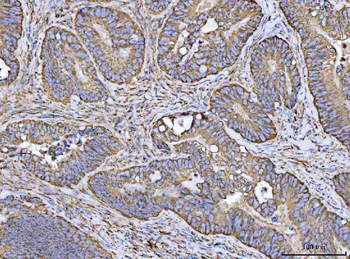 Porin/VDAC1 Rabbit Polyclonal Antibody