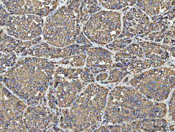 Porin/VDAC1 Rabbit Polyclonal Antibody