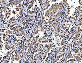 Porin/VDAC1 Rabbit Polyclonal Antibody