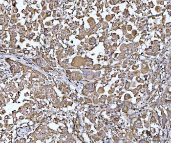 PYCR1 Rabbit Polyclonal Antibody
