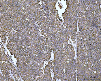 PYCR1 Rabbit Polyclonal Antibody