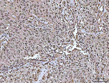 ASC/TMS1/PYCARD Rabbit Polyclonal Antibody