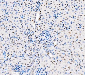 ASC/TMS1/PYCARD Rabbit Polyclonal Antibody
