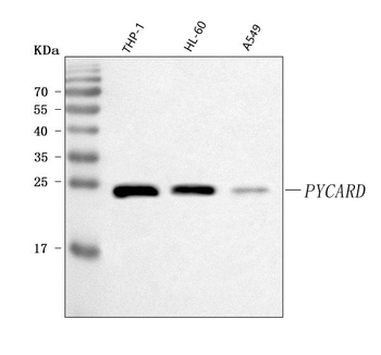 ASC/TMS1/PYCARD Rabbit Polyclonal Antibody