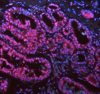 ASC/TMS1/PYCARD Rabbit Polyclonal Antibody