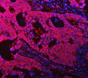 ASC/TMS1/PYCARD Rabbit Polyclonal Antibody