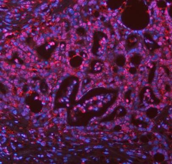 ASC/TMS1/PYCARD Rabbit Polyclonal Antibody