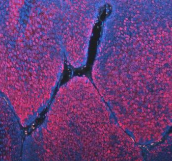ASC/TMS1/PYCARD Rabbit Polyclonal Antibody