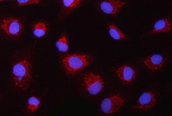 ASC/TMS1/PYCARD Rabbit Polyclonal Antibody