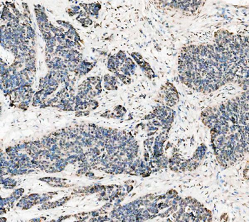ASC/TMS1/PYCARD Rabbit Polyclonal Antibody
