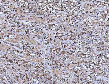 ASC/TMS1/PYCARD Rabbit Polyclonal Antibody
