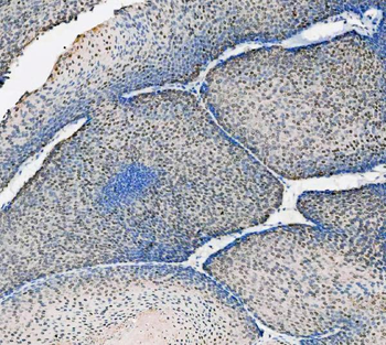 ASC/TMS1/PYCARD Rabbit Polyclonal Antibody