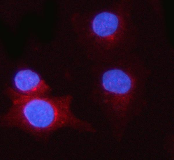 PSME1 Rabbit Polyclonal Antibody