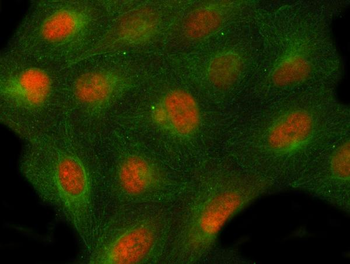 PSMD4 Rabbit Polyclonal Antibody