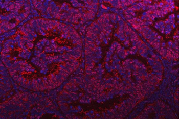 PSMD4 Rabbit Polyclonal Antibody